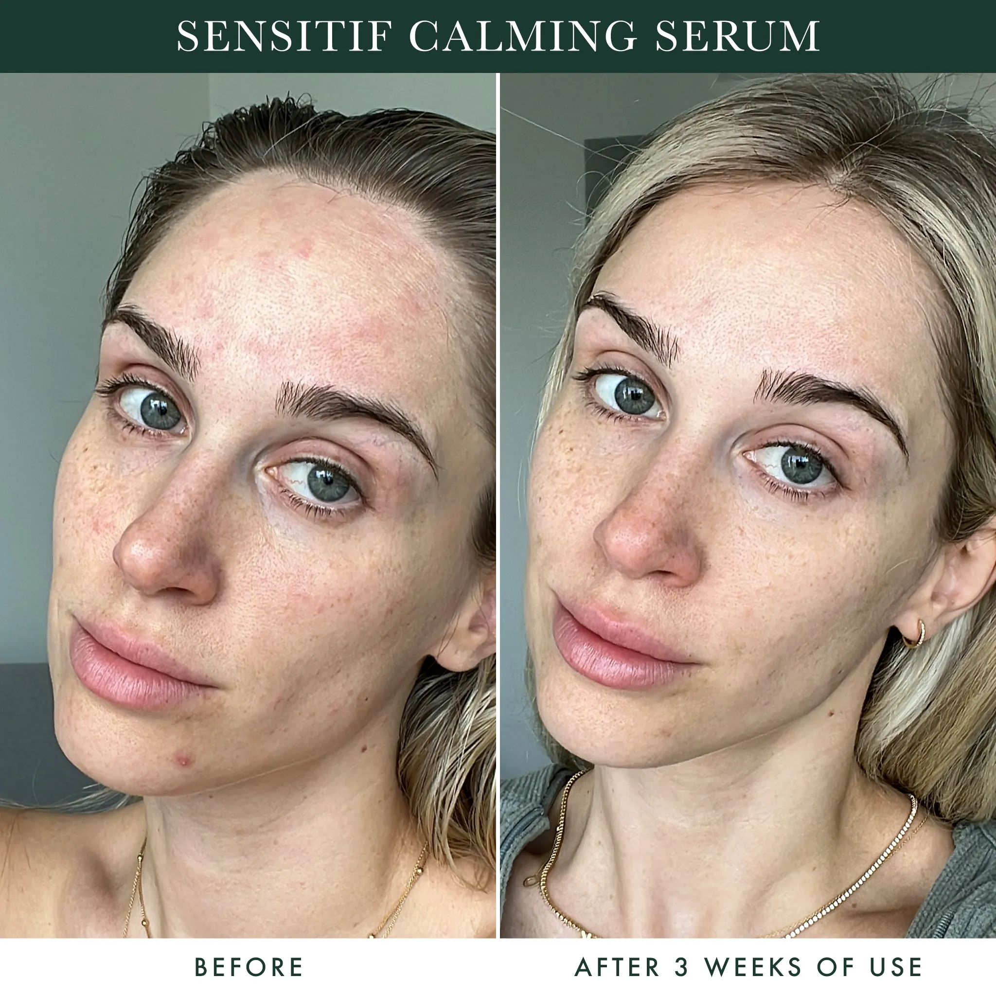 Sensitif Calming Serum / Skin Barrier Repair